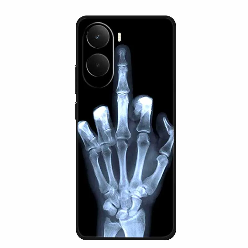 Casing Xiaomi Poco M7 4G 6.9" Serigala Singa Harimau Hitam Silikon Lembut untuk Xiaomi Poco M7 Penutup Belakang M 7 Coque Capa