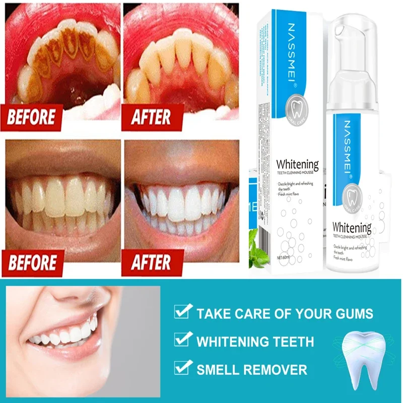 

Teeth Cleansing Whitening Mousse Removes Stains Whitening Toothpaste Oral Mousse 60ml Staining Hygiene Teeth Health Care