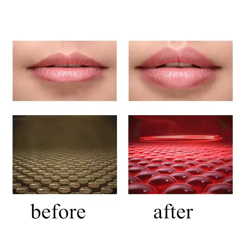 2024Enlarge Sexy Apple Full Beauty Equipment Waterproof Lips Care Machine Electric Lip Plumper