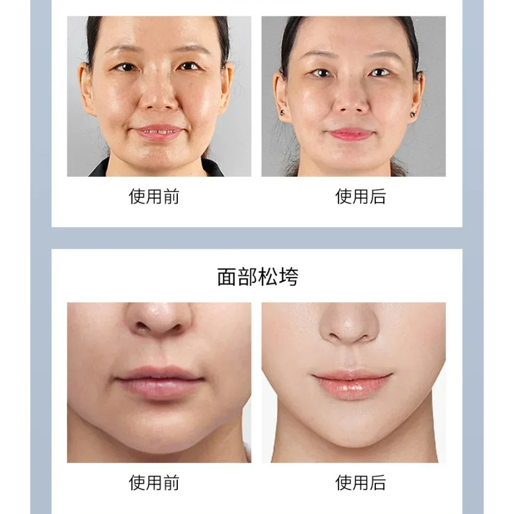 3D Anti-Aging Freeze-Dried Powder Anti-wrinkle Fiming Lifting Smoothing Tender Sin Moisturizing and Nourishing Skin Care Product
