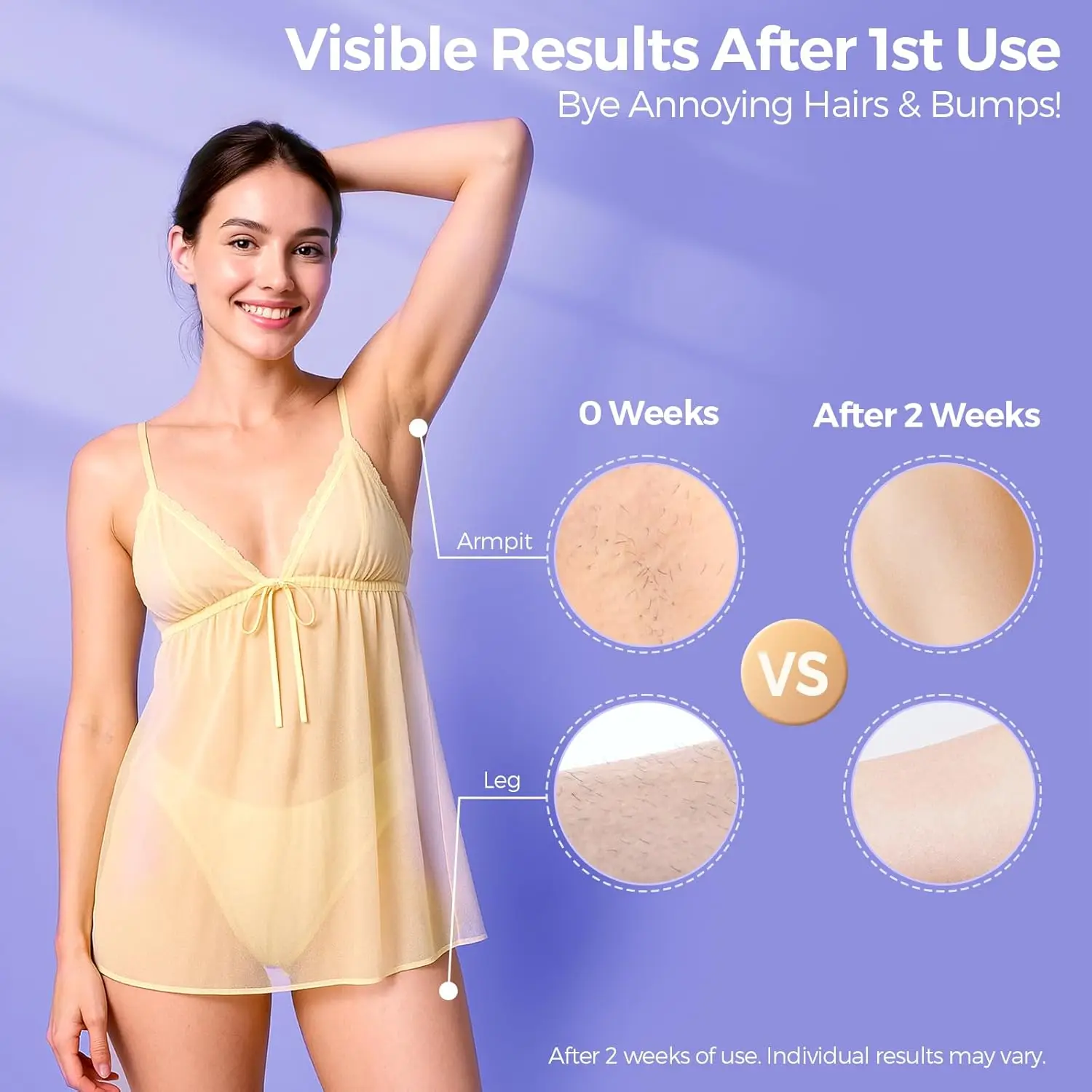 Painless IPL Laser Hair Removal Device with 5℃ Cooling, 999,999 Flashes, 5 Levels, 2 Modes, for Face & Body – 3-in-1 Set