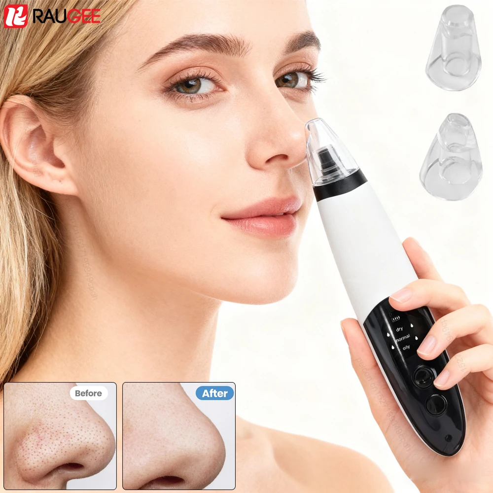 فراغ كهربائي مزيل الرؤوس السوداء تنظيف الوجه العناية ببشرة الوجه إزالة المسام المطهر لمسام الوجه العميق مزيل الرؤوس السوداء #1