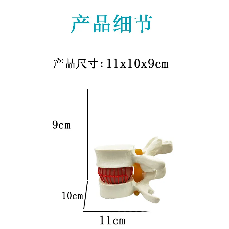 人体解剖学スケルトン脊椎腰椎椎間板ヘルニア椎骨変性マネキン椎間教育モデル