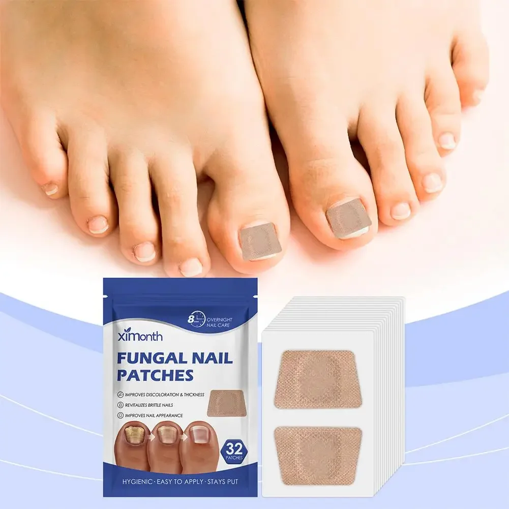 32 Pcs Paronychia Treatment Patch Fungus Removal Nail Correction Stickers Ingrown Nails Recover Pedicure Tools Repair Patches