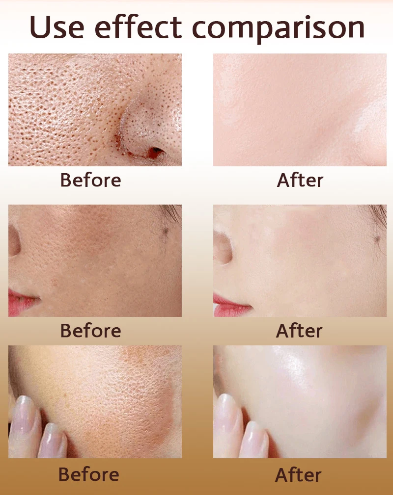 Effective Pores Remover Pore Shrinking Serum Shrink Tightening Minimizing  Serum Facial  Skin Care Products Acne Treatment