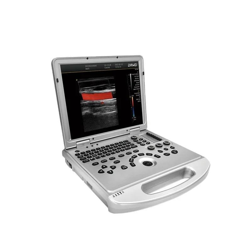 portable USG ultrasound machine color Doppler DW-L3