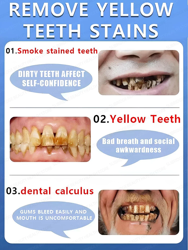 Resuelve dientes amarillos