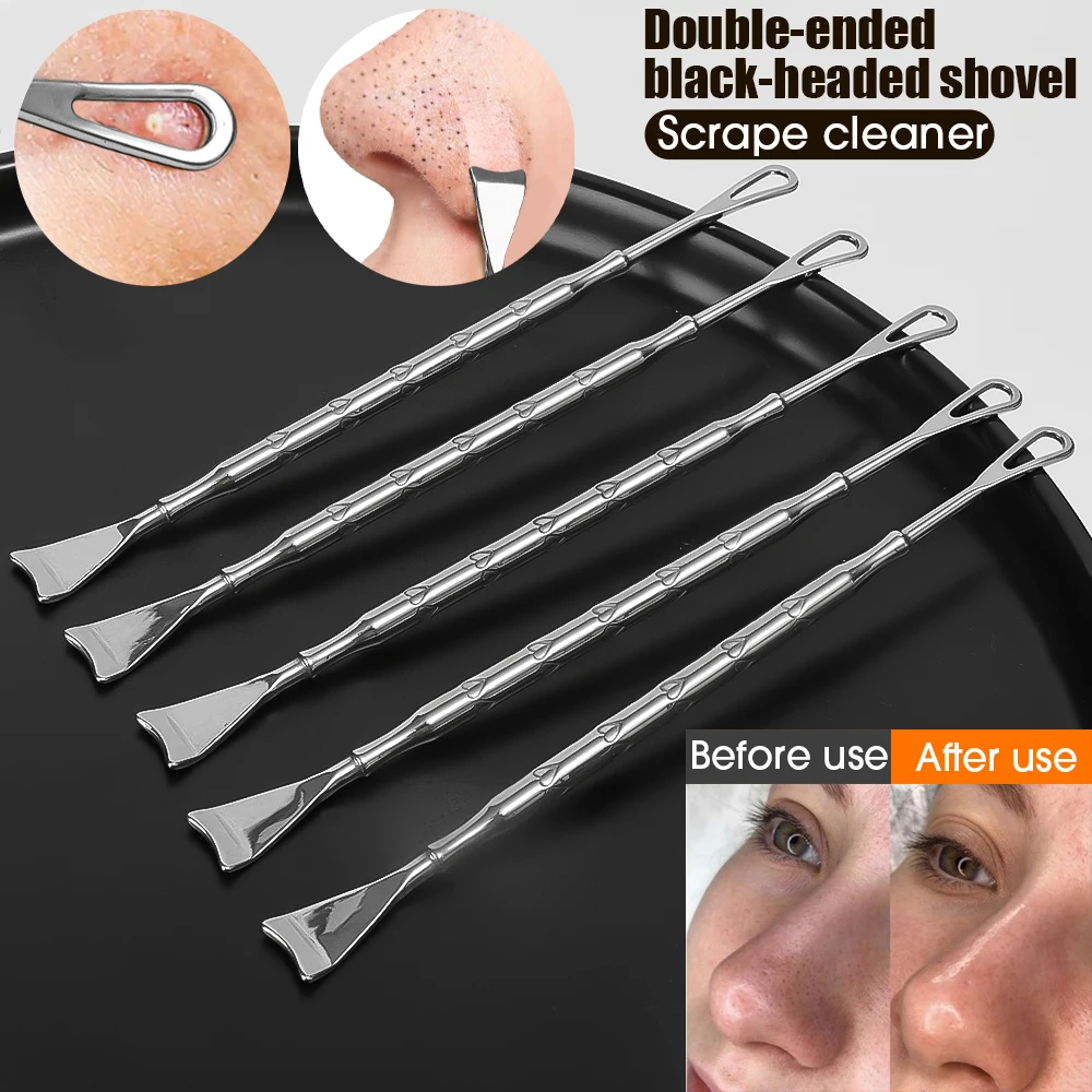 Double Head Blackhead Scraper Remover Pimple Popper Tools Acne Needle Removing Whitehead Popping Nose Facial Blemish Extractor