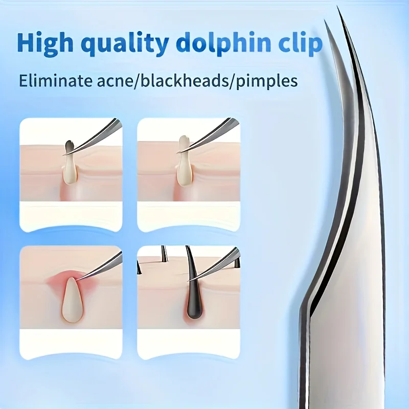 Pinzette di precisione in acciaio inossidabile per sopracciglia e punti neri, adatte per pulire tutte le imperfezioni del viso beige chiaro