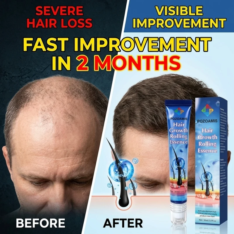 Roller‑Ball Hair Serum Scalp Nourishing Hair Care Liquid Gentle Root‑Care Essence Improve Hair Appearance For Daily Home Scalp & Hair Maintenance Treatment