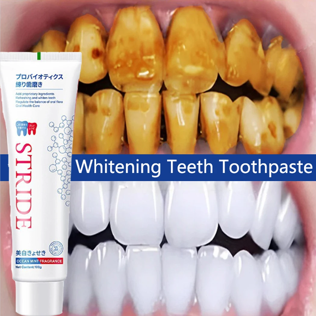 Whitening Teeth Toothpaste Dental Calculus Brightening Remover Plaque Remover Fresh Breath Preventing Periodontitis Dental Care