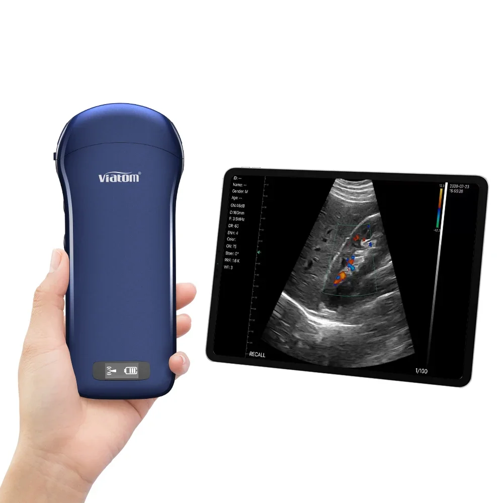 Viatom 128 Elements Wireless Ultrasound Probe Linear/ Convex/ Phased Array 256 Level Image Gray Handheld Ultrasound Scanner