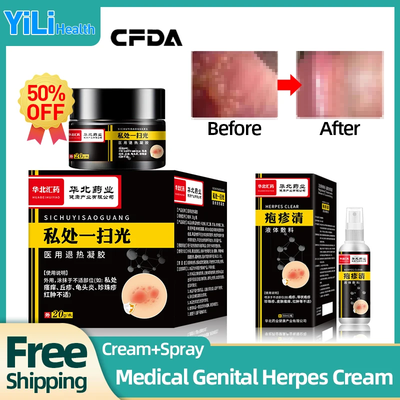 

Genital Herpes Outbreak Treatment Cream for Men and Women Herpes Simplex Cure Medicine Shingles Skin Medication CFDA Approve