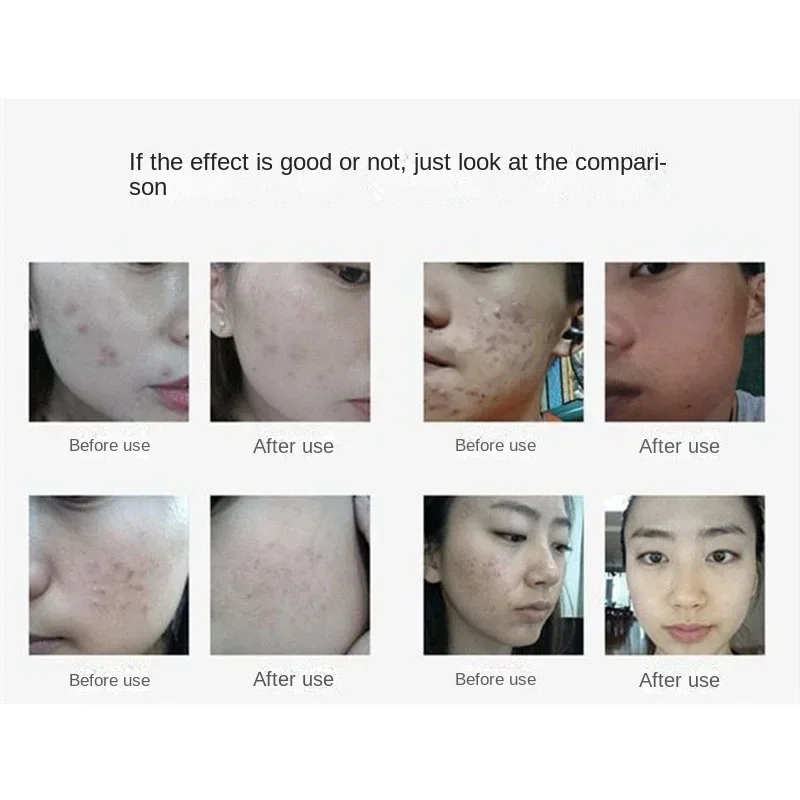 6 in 1RF Vacuum Cleaner Hydraulic Water Oxygen Jet Peeling Hydraulic Microdermabrasion Skincare Beauty Machine