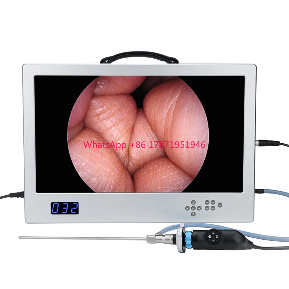 

4 In 1 Integrated Endoscope Camera System All in one Medical Portable 80w LED Cold Light Source HD 24 inch Endoscope Monitor