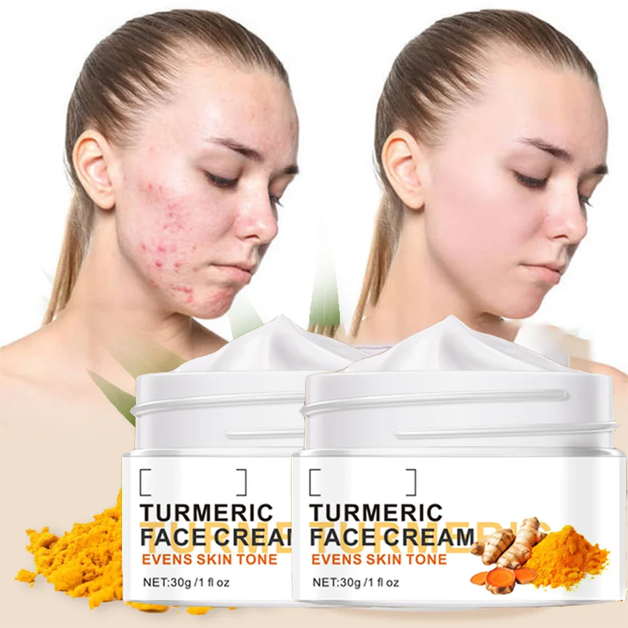 

2 Box Turmeric Glutathione Face Cream Glutathione Whitening Face Cream Reduce Dark Spots Face Whitening Cream