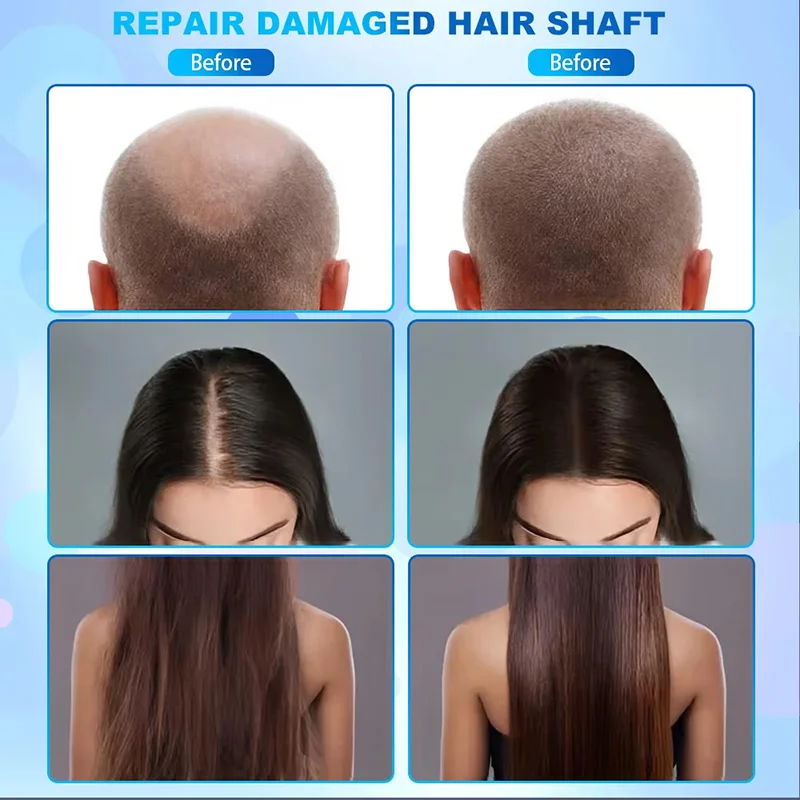 5 In 1 Scalp Skin Equipment Hair-scalp-analyzer Treatment Polarizado Hair Scalp Analyzer Machine