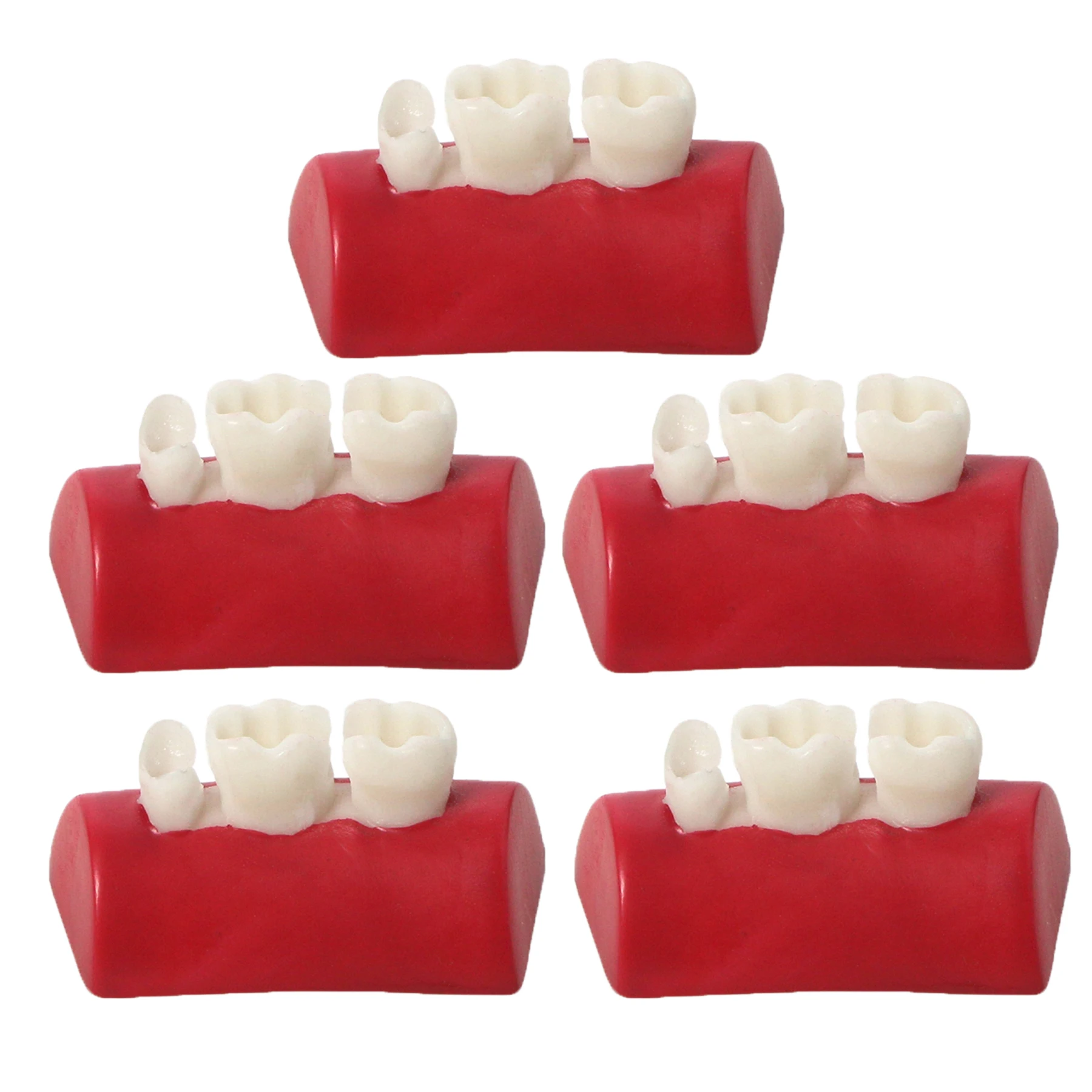 5pcs Dental Inlay Exercise Model Block Filling Exercise Typodont Resin Materials for Dentistry Teaching Study