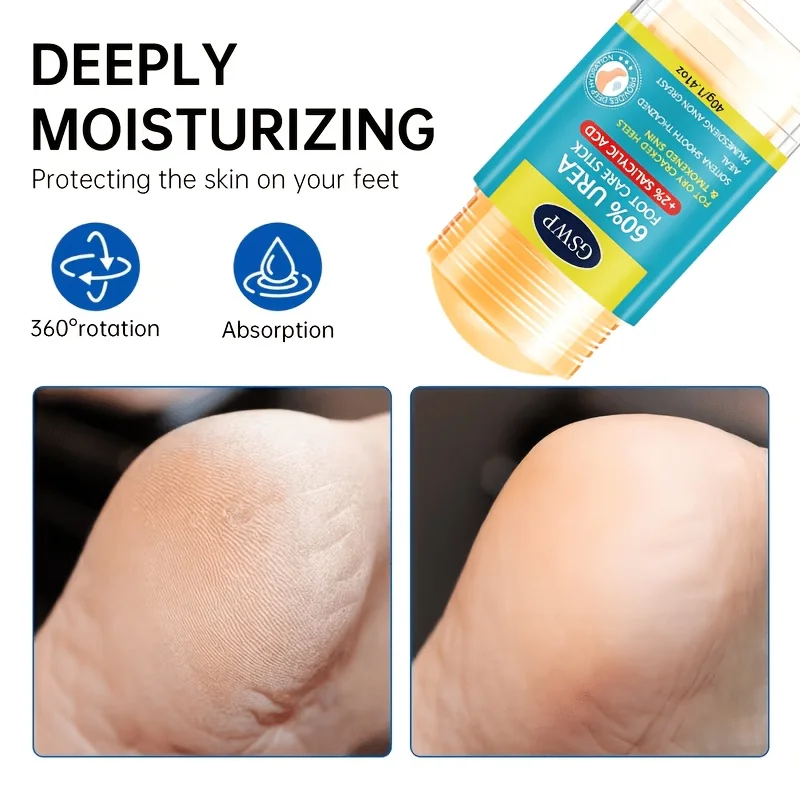 GSWP 60% Urea Foot Care Stick, Containing 2% Salicylic Acid, Is Designed for Dry, Cracked Feet. It Soothes Dry. 40g/80g view 4