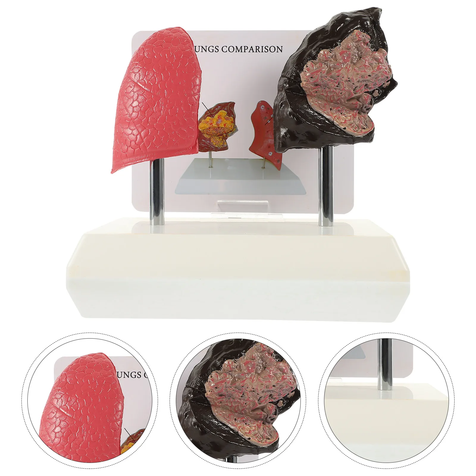 1Pcs Smoking Lung Teaching Anatomy Respiratory Lung Comparison Educational School Display Comparison