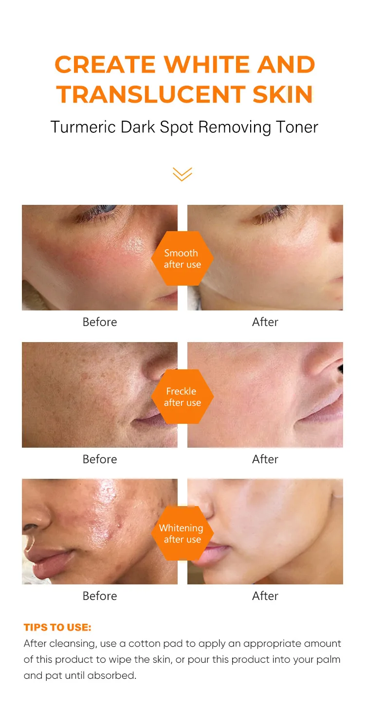 Turmeric Toner Dark Spot Corrector Brightening Facial Niacinamide Kojic Acid Glow