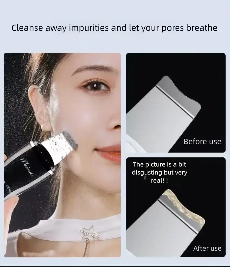 منظف للبشرة بالموجات فوق الصوتية، منظف كهربائي للرؤوس السوداء والمسام للتقشير العميق - جهاز تنظيف الوجه للرؤوس السوداء #2