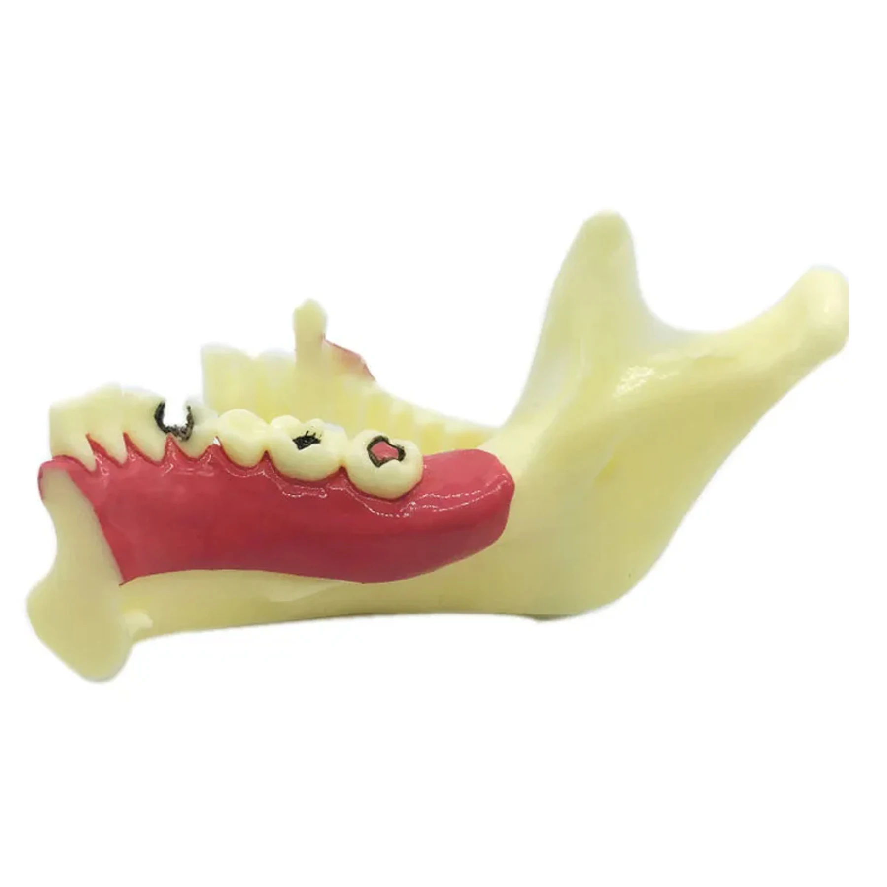 Stomatologiczny model endodontyczny o niskiej szczęki Model anatomiczny prawych tkanek żółciowych anatomiczny dziąseł do nauki i nauczania