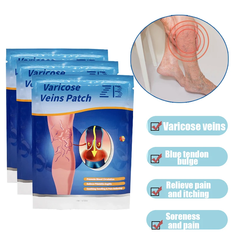 Traditional Chinese Medicine Varicose Veins Patches Relieve Numbness Swollen Pain Dressing Promoting blood Circulation Patches