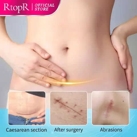 RtopR-Crema de Mango para la piel, blanqueador e hidratante, rejuvenecimiento de la piel, nutritivo, cuidado de la piel