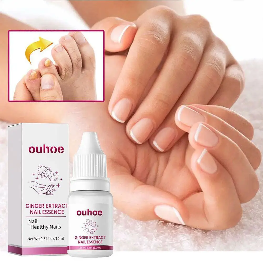 OUHOE 10ml Ginger Nail Essence Nourishing Rough Nails Anti Paronychia Nail Fungal Nail Treatment Essence Hand Foot Care