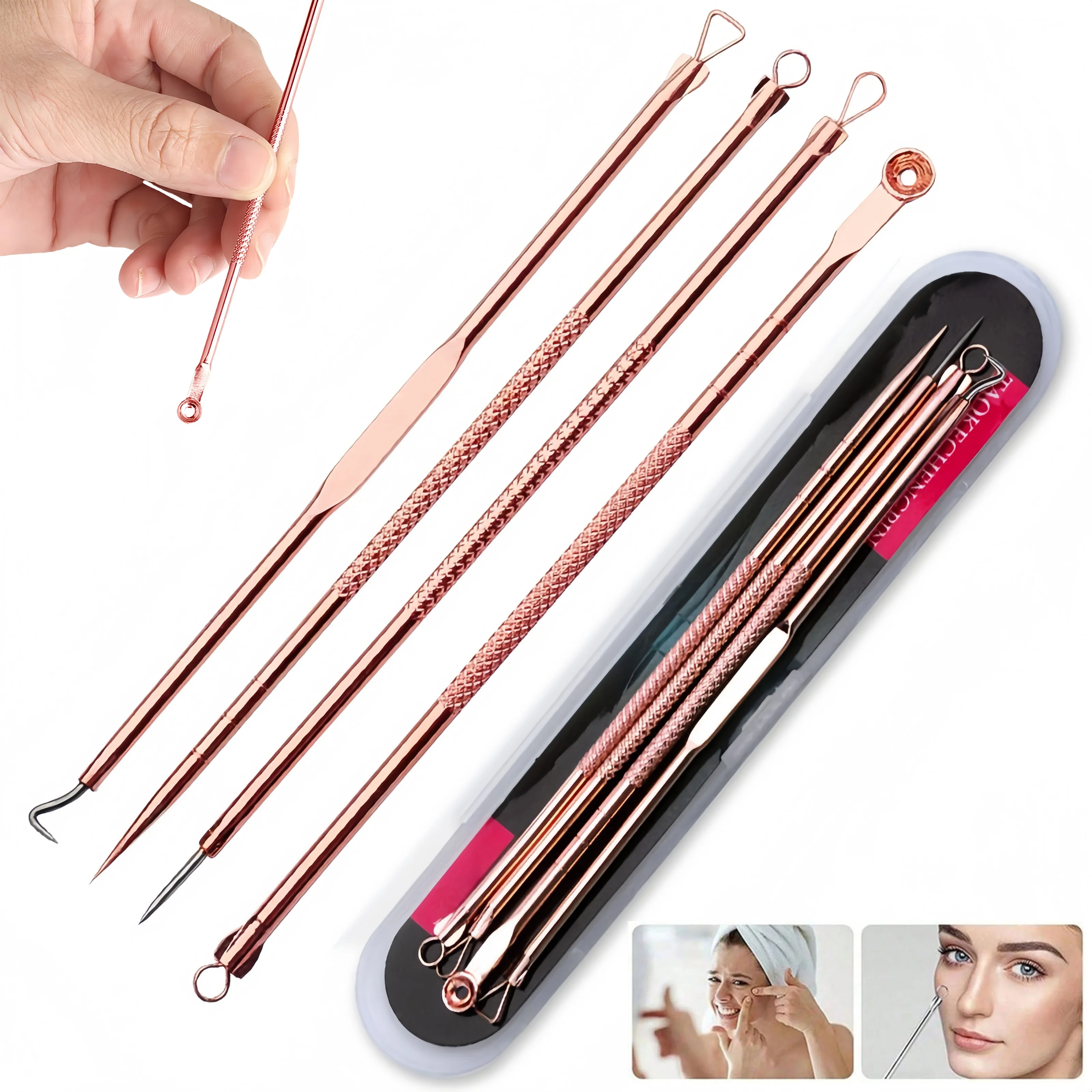 4-teiliges Entferner-Pickel-Komedonen-Extraktor-Werkzeug, Akne-Entfernungsset, Behandlung für Makel, Risikofreie Entfernung von Gesichtsunreinheiten