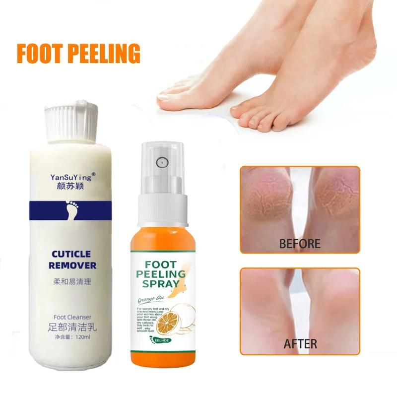 

Foot Exfoliator Softener Cream Spray Kit 7 Seconds Remove Dead Skin Calluses Foot Mask Anti-Cracked Heel Enhancer Nail Pedicure