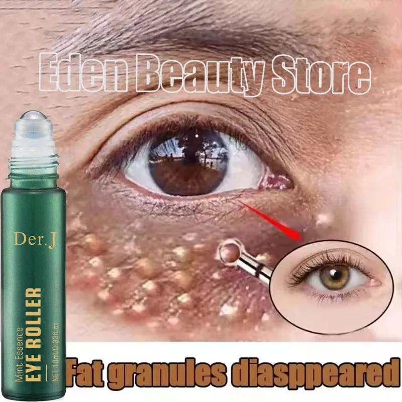 Entfernen Sie Augenfettpartikel Serum Milia Behandlungsprodukte Anti Schwellungen Entzündungshemmende Reparatur Hautbarriere Koreanische Hautpflege