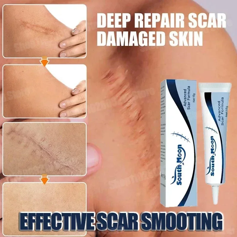 Scar effective repair surgical scars stretch marks acne pits pockmarks burn scars repair