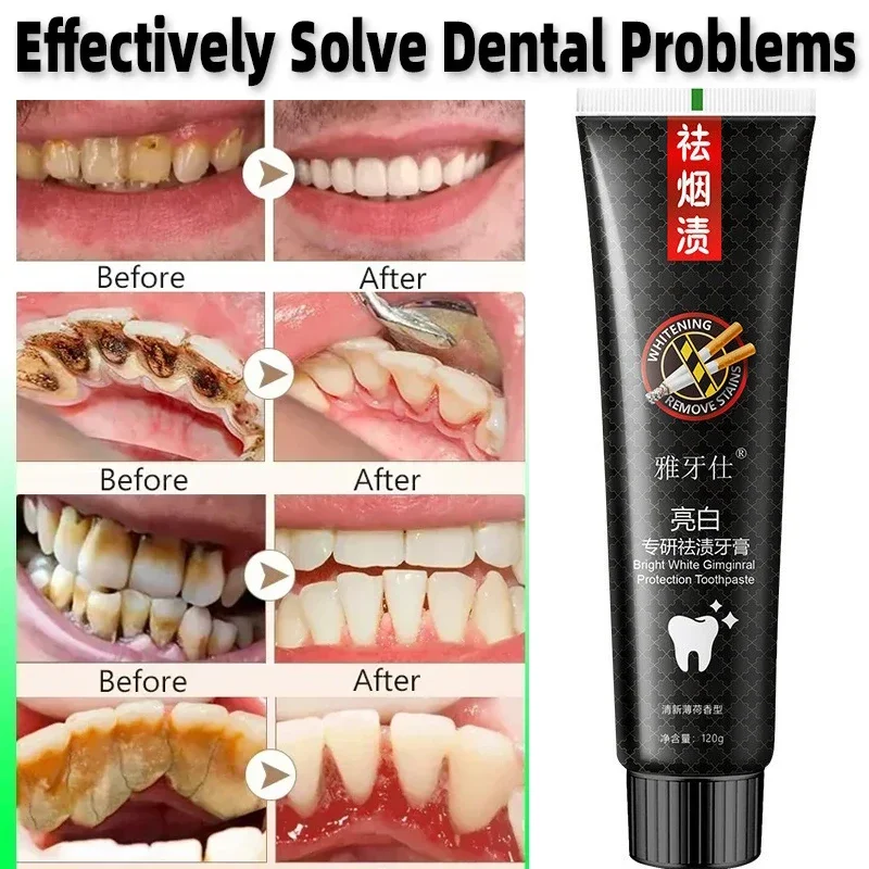 Fast Remove Smoke Stains Toothpaste Remove Plaque Stain Bad Breath Dental Calculus Oral Hygiene Clean Fresh Breath Dental Tools