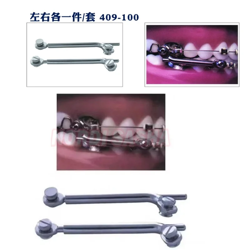 1 conjunto de aparelho dental herbst conjunto denturum parafuso soquete telescópico ortodôntico classe ii correção
