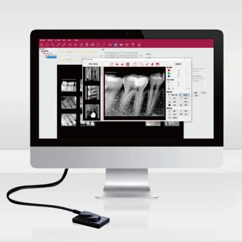 

Runyes DR730 Sensor Dental X ray Sensor Digital RVG Sensor Dental Imaging System