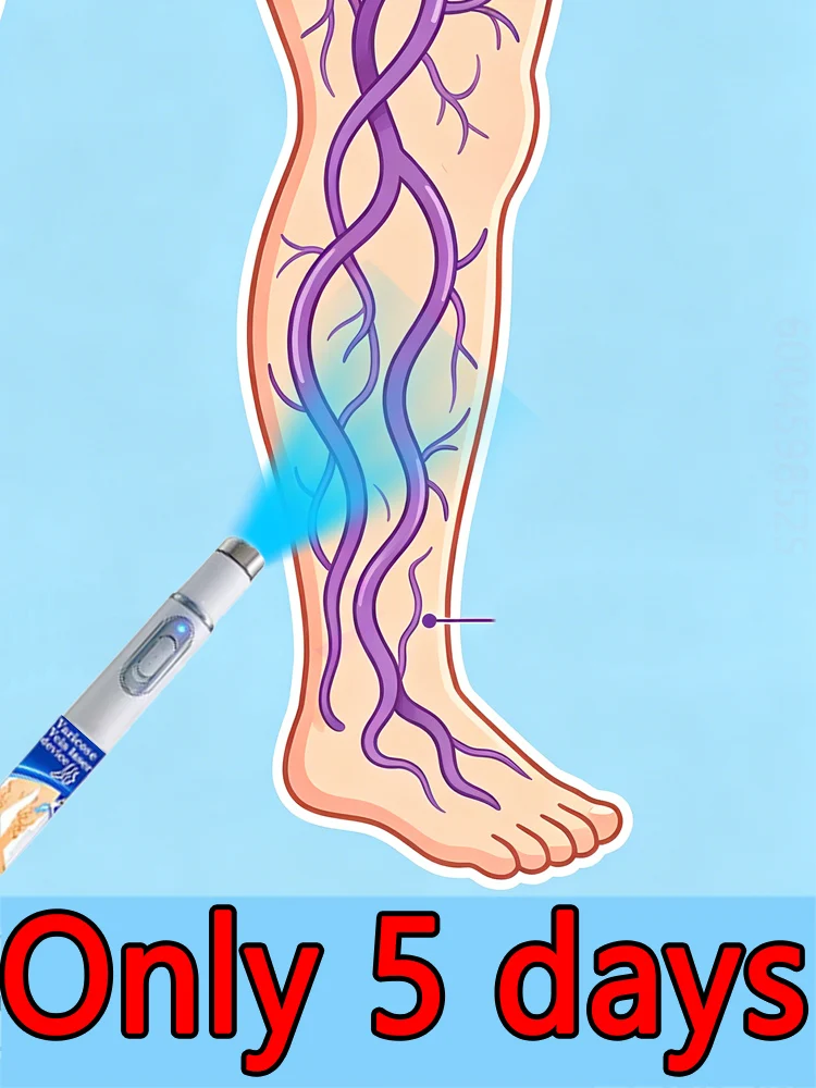 Fast delivery; covers 99.9% of the legs and feet.