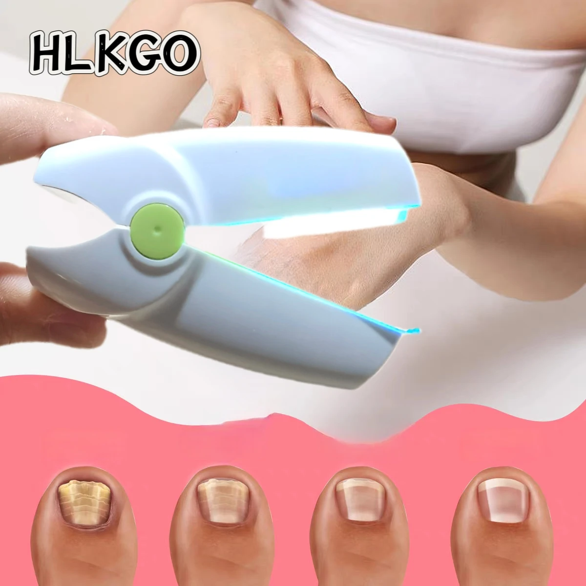 

At Home Nail Fungus Laser Device - 470nm & 905nm Combination Therapy for Effective and Safe Fungal Infection Removal