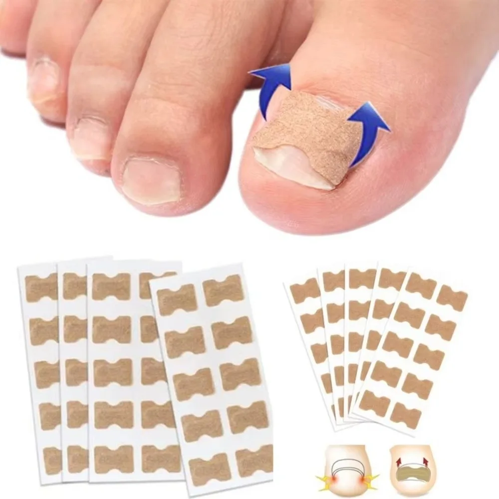 100Pcs Adhesive Ingrown Toenail Correction Stickers Elastic Nonwoven Flexible Toenail Shaping Strips Breathable