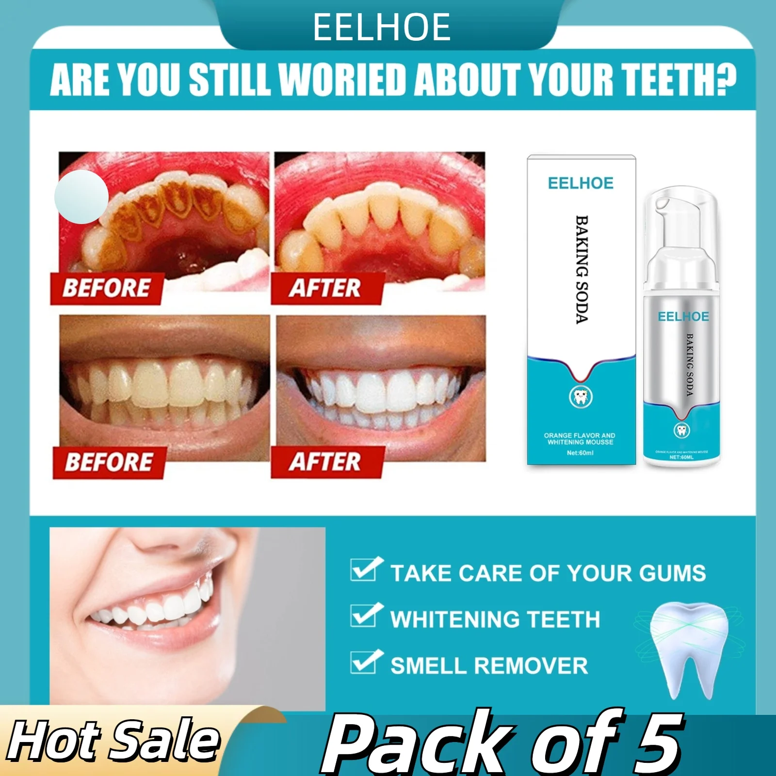 5pcs Press-type Tooth Mousse Removes Smoke Stains, Removes Yellow Teeth, Freshens Breath, and Effectively Whitens The Mouth.