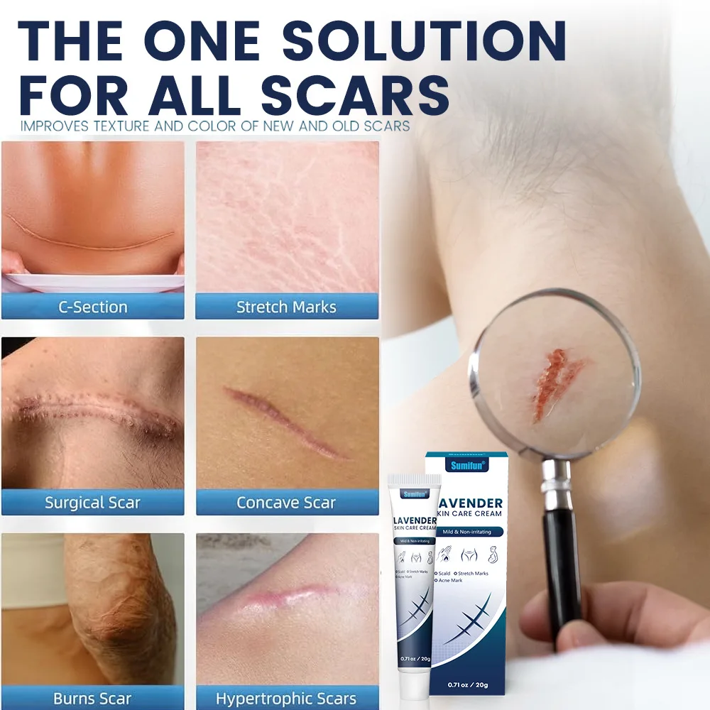 جل الندبة الطبيعية زيت اللافندر يتلاشى الندبات القديمة كيلويد إصلاح العلاج علامات التمدد تخفيض بعد العملية حب الشباب بقعة مزيل #3