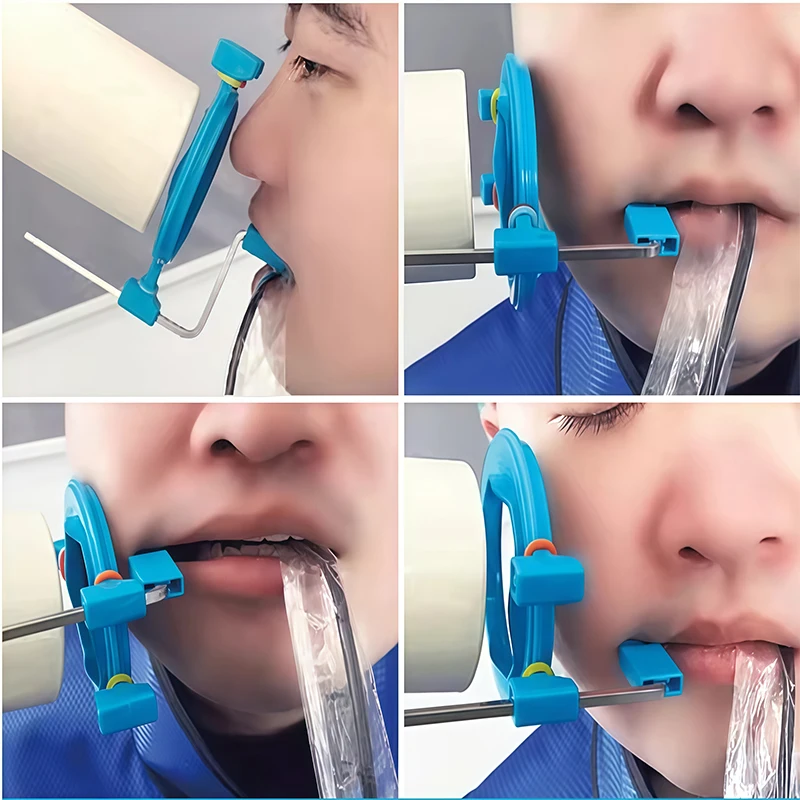 1 Set Dental X-ray Film Fixed Bracket X Ray Sensor Positioner Holder Complete Film Positioning System For Senor Type 2.0
