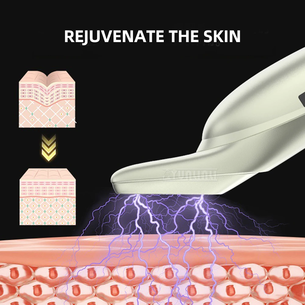 

Household Plasma Acne Removal Beauty Device Facial Cleaner Acne Marks And Acne Blackhead Portable Beauty Tool