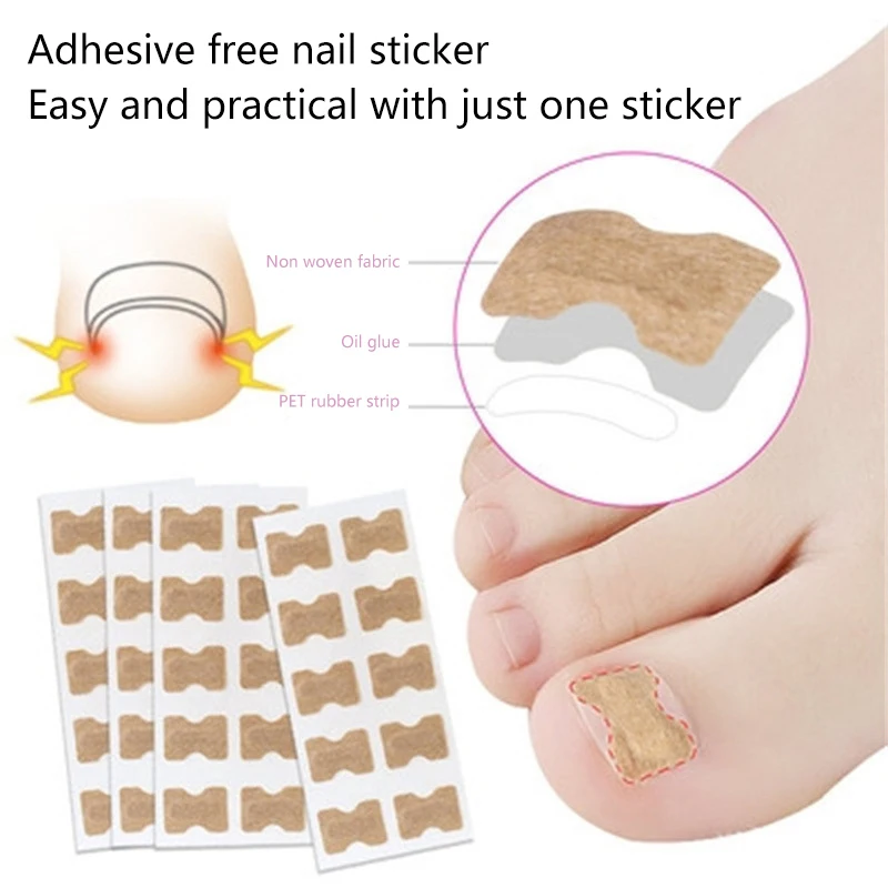 100 Pcs Toenail Fungus Patch Sticky Nail Repair Patch Nail Ingrown Correction Sticker Toenail Care Paronychia Nail Patch