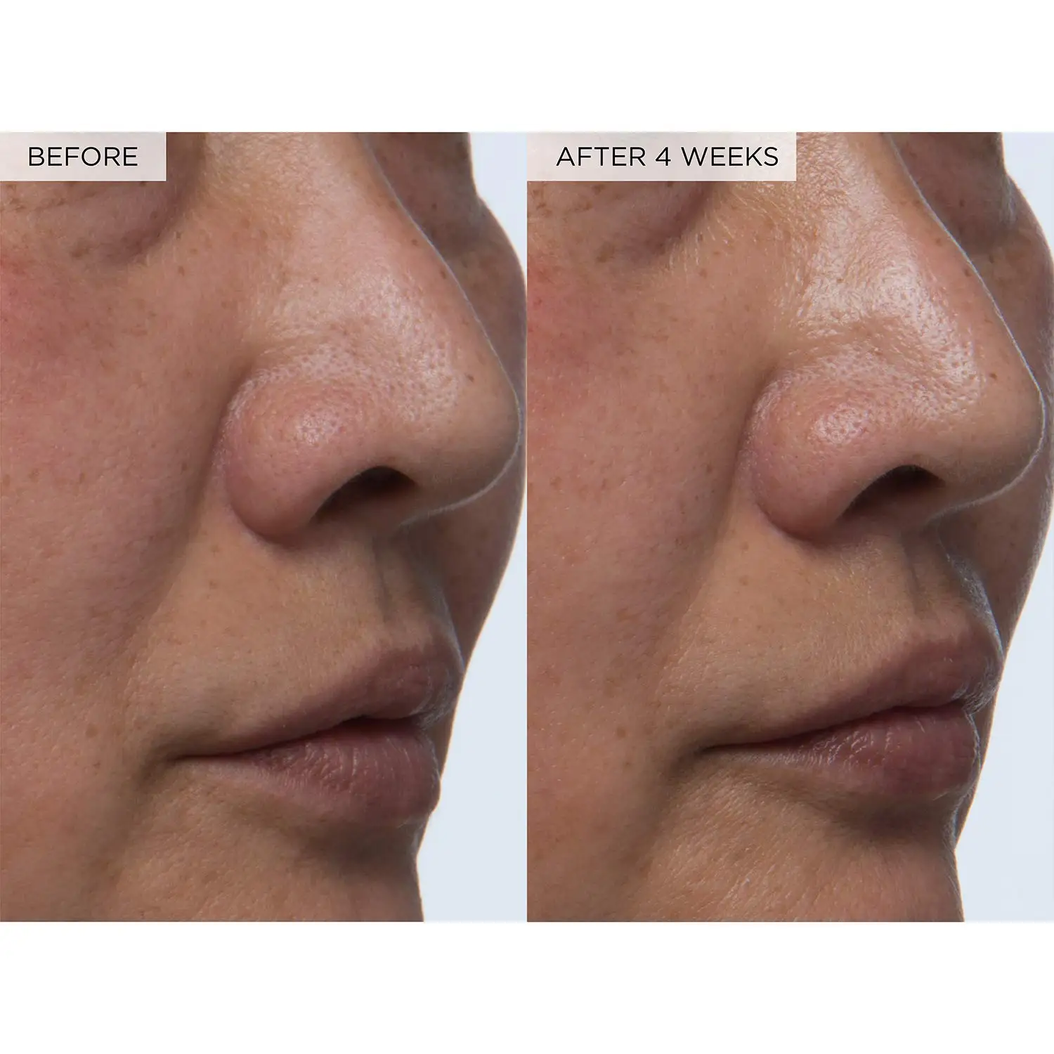 PHA + BHA 페이스 토너 - 한국 스킨케어 모공 축소 및 부드러운 얼굴 각질 제거제, 탄력 및 수분 공급 150ml