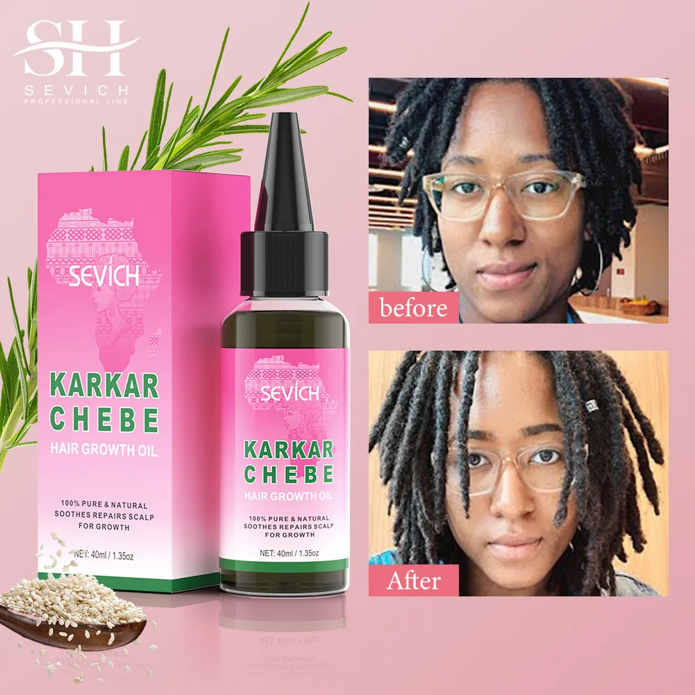 Chebe Fast Hair Growth Sevich Traction Alopecia Hair Karkar Oil Anti Hair Break Hair Strengthen Hair Loss Care Repair Damage