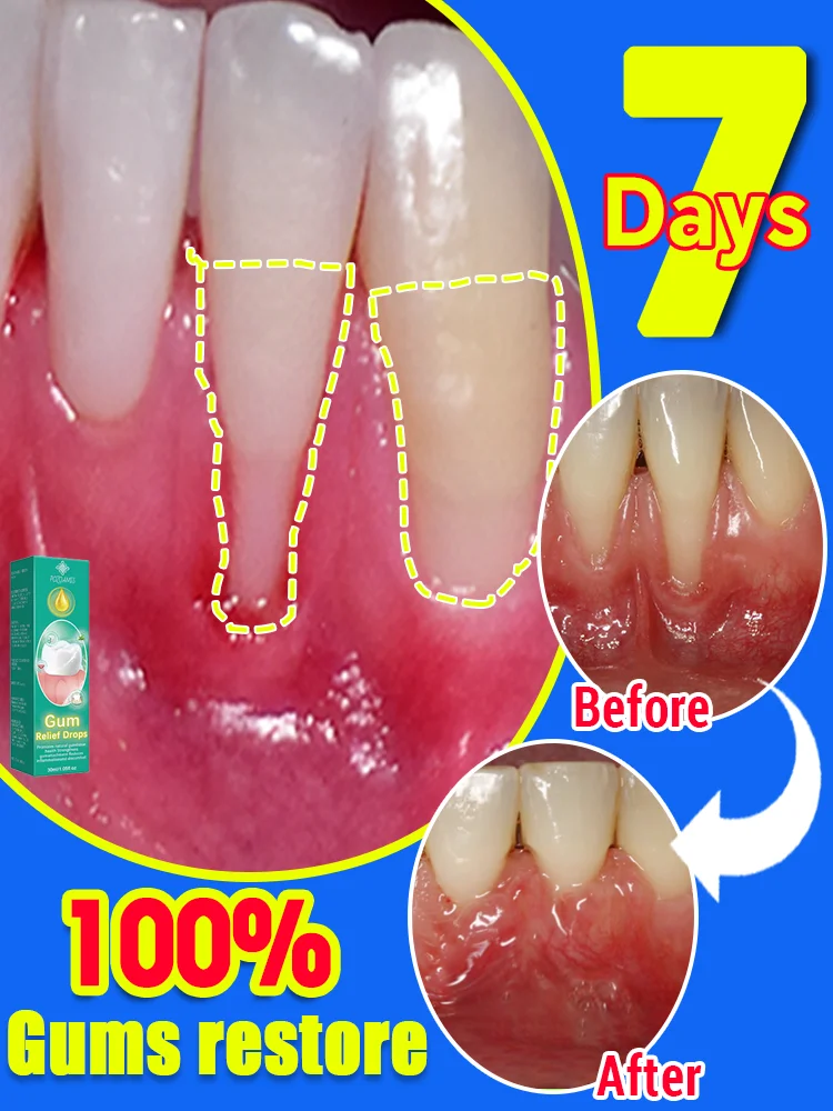 

Gum tissue regeneration drops, the hottest selling product in 2025