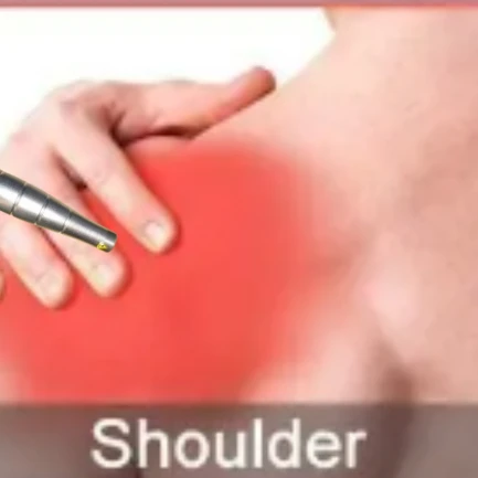 

Rechargeable Cold Laser Device for Body Pain Management - Shoulder Knee Ankle Physiotherapy Recovery Equipment Non-Invasive