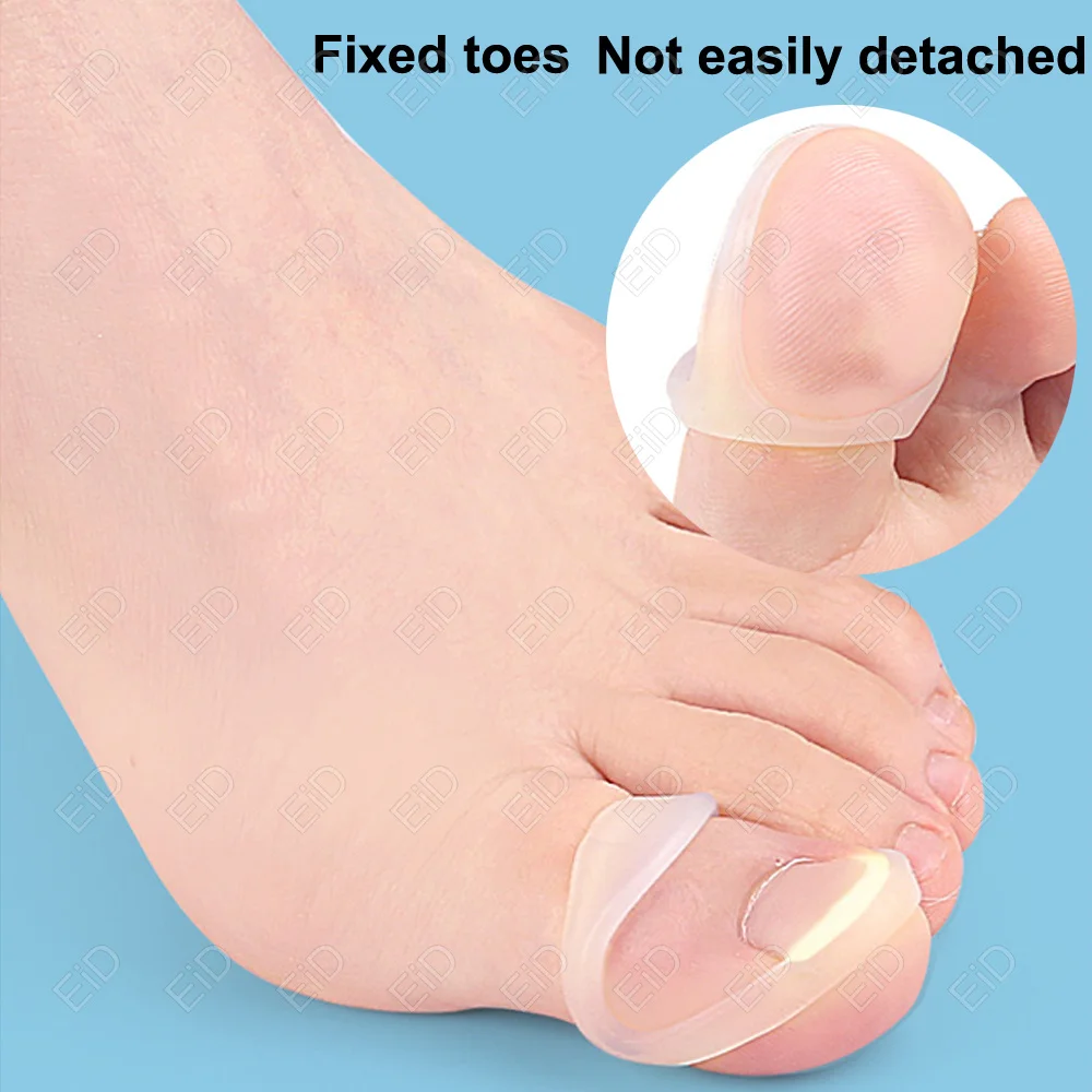 EiD Orthopedic Paronychia Toenail Corrector Strips Anti Nail Patch Feet Sleeping Nail Patch Nails into the Flesh Long Toe Pads